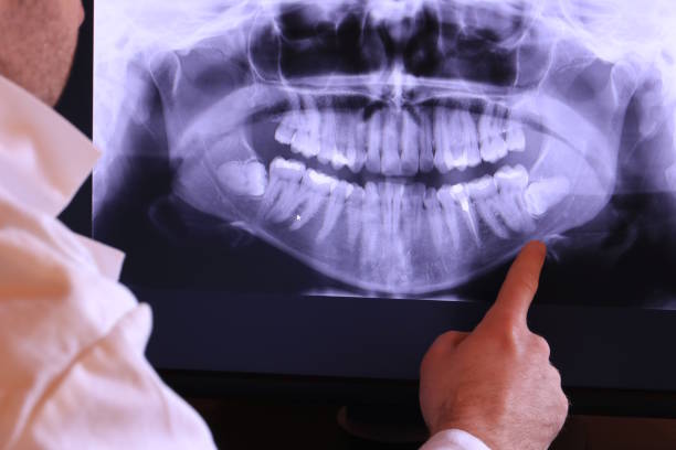 Best 24-Hour Emergency Dentist in Reed City, MI
