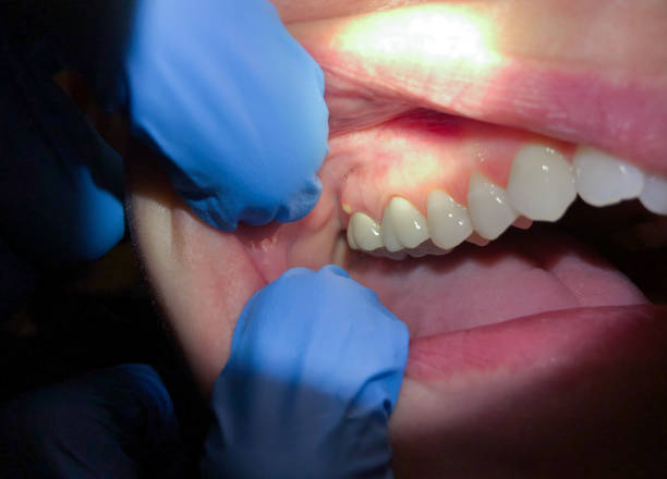 Best Emergency Cosmetic Dentistry in Reed City, MI
