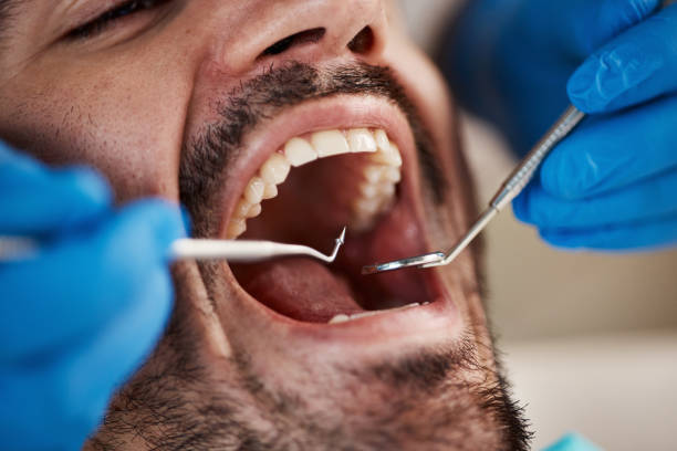 Best Weekend Emergency Dentist in Reed City, MI