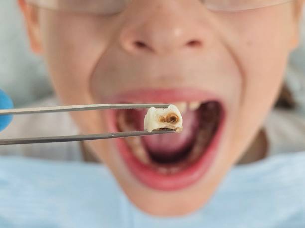 Best Holiday Emergency Dentist in Reed City, MI